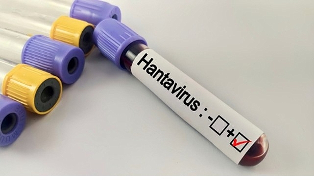 hantavirus-bir-salgina-donusur-mu.jpg
