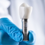 implant tedavisi (4)