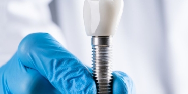 implant tedavisi (4)